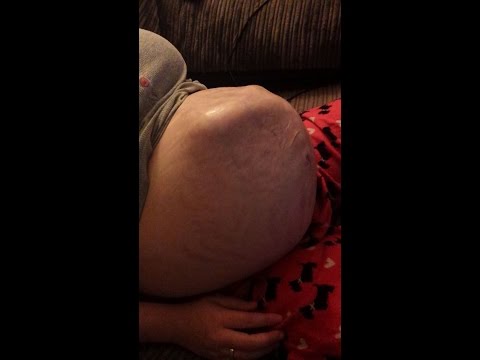 بالفيديو لقطات غريبة لجنين يتحرك داخل بطن أمه