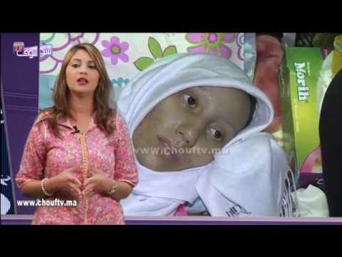 شاهد استقبال حنان المصابة بالسرطان لعيد الفطر