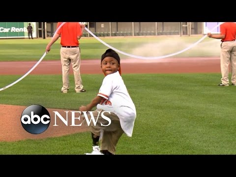 فيديو الطفل صاحب أول ذراعين مزروعتين يرمي كرته الأولى