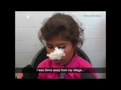 بالفيديو هندي يقضم جزءًا من أنف زوجته على طريقة مايك تايسون