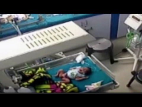 ممرض عديم الرحمة ينزع ساق طفل في مستشفى هندي