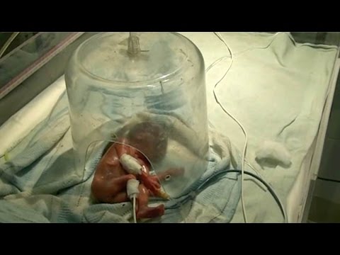 طفلة تعود للحياة قبل حرق جثتها