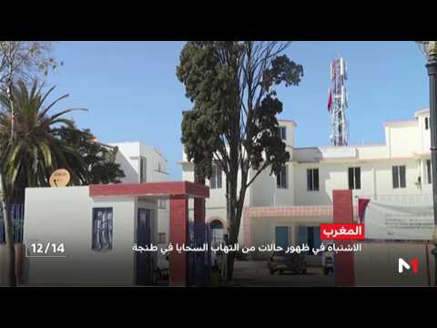 شاهد الاشتباه في ظهور حالات لمرض إلتهاب السحايا في طنجة