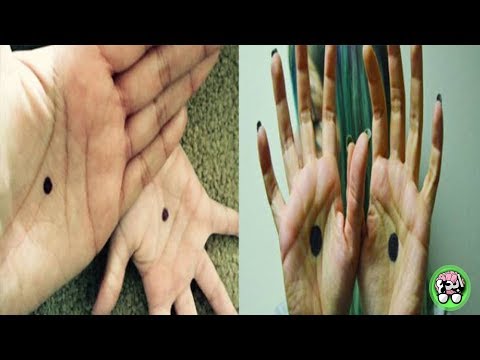 نصائح باستدعاء الشرطة عند رؤية شخص بيده نقطة سوداء