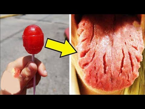 7 أنواع من الحلوى تسبب العديد من الأمراض