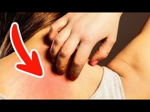 تعرف على العلامات المبكرة لمرض السرطان