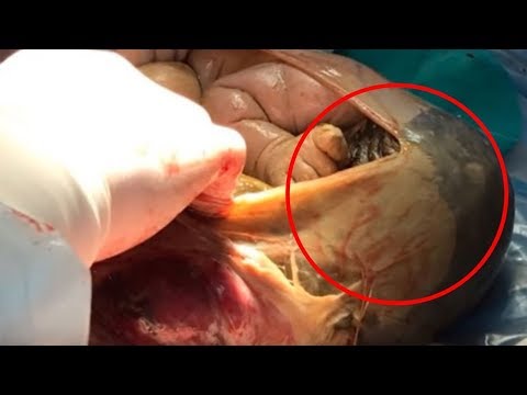 شاهد روسية تتعرّض إلى موقف خطير لرفضها زيارة طبيب الولادة