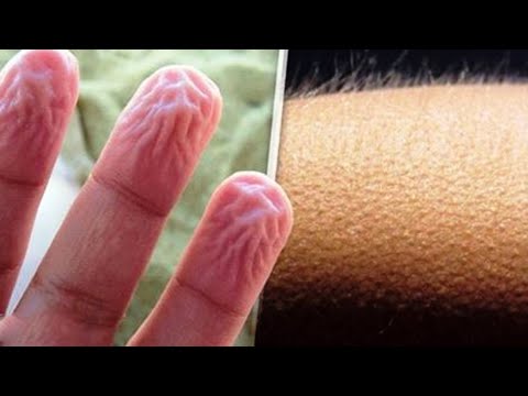 شاهد 10 أشياء تحدث في جسدك دون أن تعرف السبب