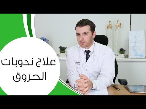 بالفيديو علاج ندوبات الحروق