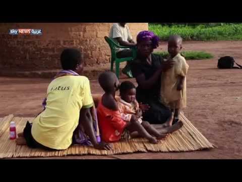 شاهد أطراف بديلة تعيد الأمل للمعاقين في أوغندا