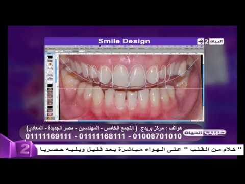 بالفيديو بالصور كيفية تصميم ضحكة الأسنان