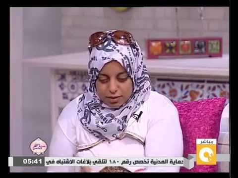 فيديو سيدة تروي تفاصيل فقء زوجها لعينها