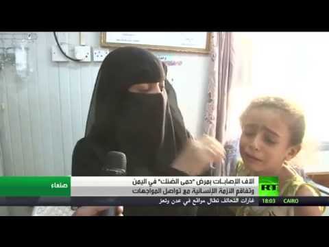 آلاف اليمنيين مصابون بـحمى الضنك