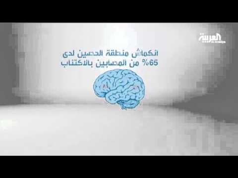 بالفيديو الاكتئاب يسبب انكماش خلايا المخ