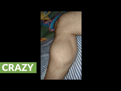 شاهد عضلة ترقص تشنجًا بعد ساعتين من التمرينات