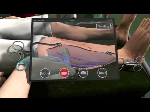 شاهد علماء يطورون نظامًا فريدًا لإجراء العمليات الجراحية عن بعد