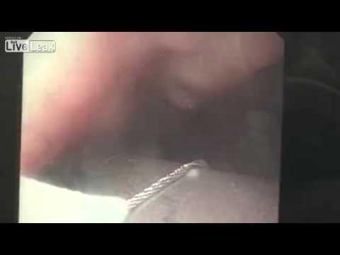 بالفيديو سيدة تبتلع ملعقة أثناء تناول طبق معكرونة