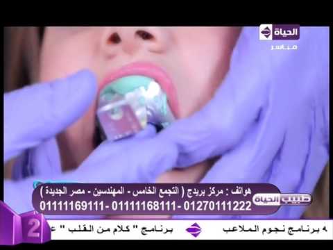 تقرير عن تركيب قشرة تجميلية لحالة حي