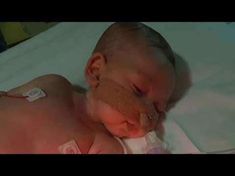48 hours to decide baby charlie gard’s life