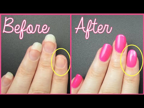 fix a broken nail fast